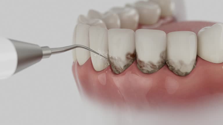 Trusted Emergency Dentist service in Martinez, GA - Dentist Open Now